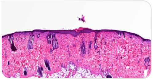 Fig-4 radiofrequency-histogramm