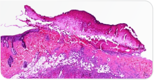 Fig-4 highfrequency-histogramm