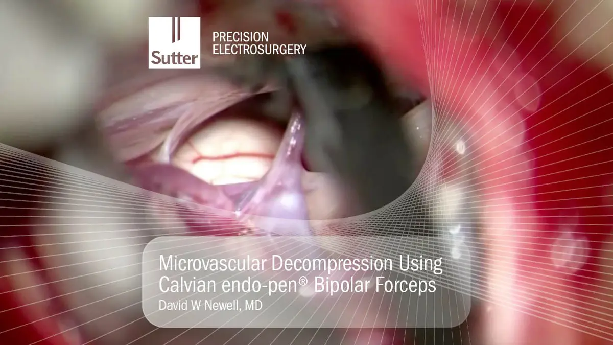 Neurosurgical procedure using Masterpiece™ non-stick bipolar forceps with CURIS® 4 MHz radiofrequency generator at University Medical Center Freiburg, Germany Microvascular decompression procedure using Calvian endo-pen® bipolar forceps by David W Newell, MD