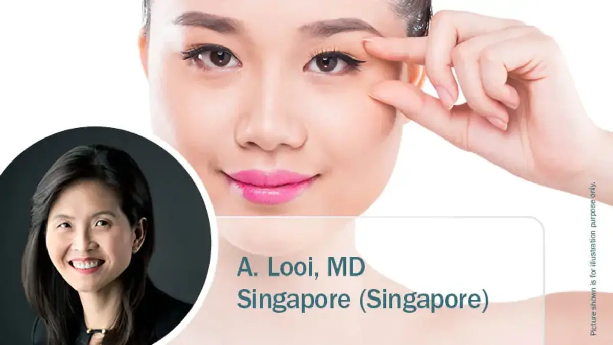 Porträt einer jungen Frau, die auf ihre Augenlider zeigt, kombiniert mit einem Bild von Dr. A. Looi aus Singapur; Hinweis auf ästhetische Lidchirurgie mit Radiofrequenz.