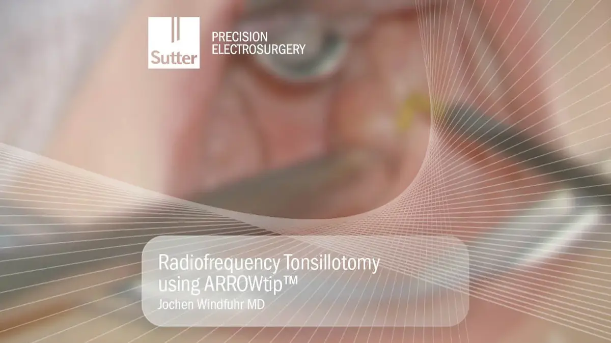 blurred-radiofrequency-tonsillotomy-arrowtip-jochen-windfuhr.jpg Blurred Radiofrequency tonsillotomy procedure using ARROWtip™ performed by Jochen Windfuhr, MD