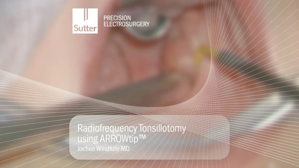blurred-radiofrequency-tonsillotomy-arrowtip-jochen-windfuhr.jpg Blurred Radiofrequency tonsillotomy procedure using ARROWtip™ performed by Jochen Windfuhr, MD