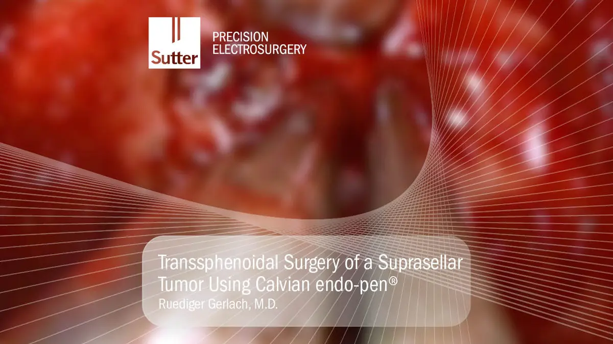 blurred-transsphenoidal-surgery-suprasellar-tumor-calvian-endopen-gerlach.jpg Transsphenoidal surgery of a suprasellar tumor using the Calvian endo-pen® by Dr. Ruediger Gerlach, shown during a neurosurgical procedure with precision electrosurgery instruments.