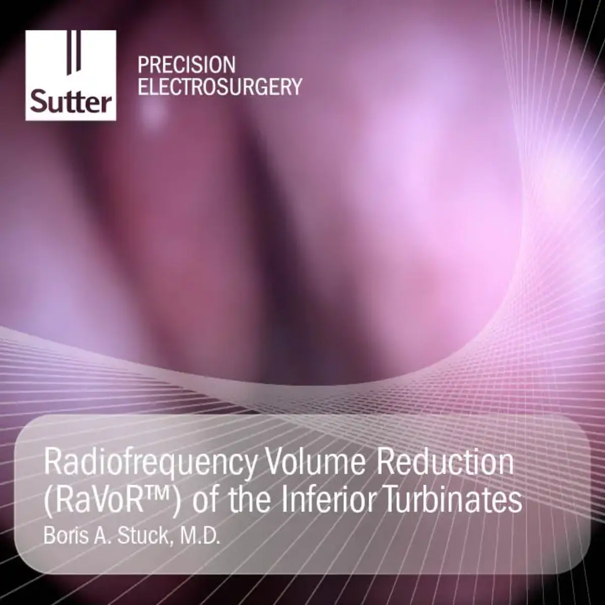 blurred-radiofrequency-volume-reduction-ravor-inferior-turbinates-boris-stuck.jpg Blurred Radiofrequency volume reduction (RaVoR™) of the inferior turbinates performed by Boris A. Stuck, M.D.