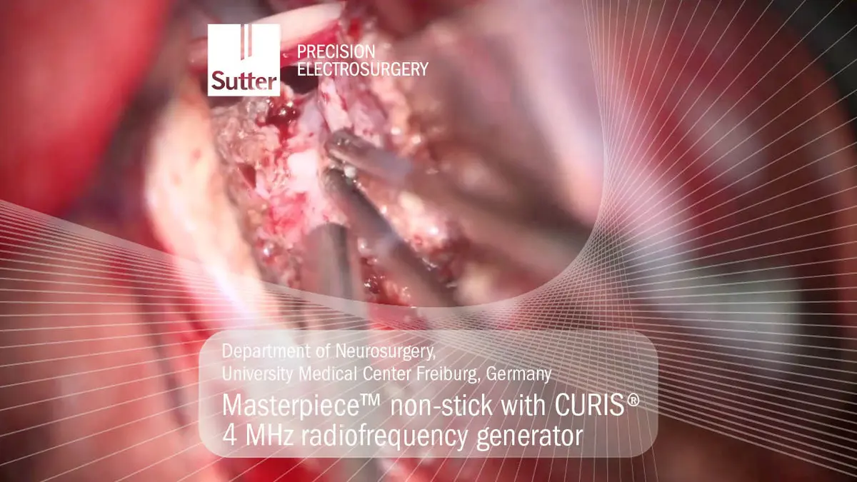 masterpiece-non-stick-curis-4mhz-radiofrequency-generator-ukf-freiburg.jpg Neurosurgical procedure using Masterpiece™ non-stick bipolar forceps with CURIS® 4 MHz radiofrequency generator at University Medical Center Freiburg, Germany
