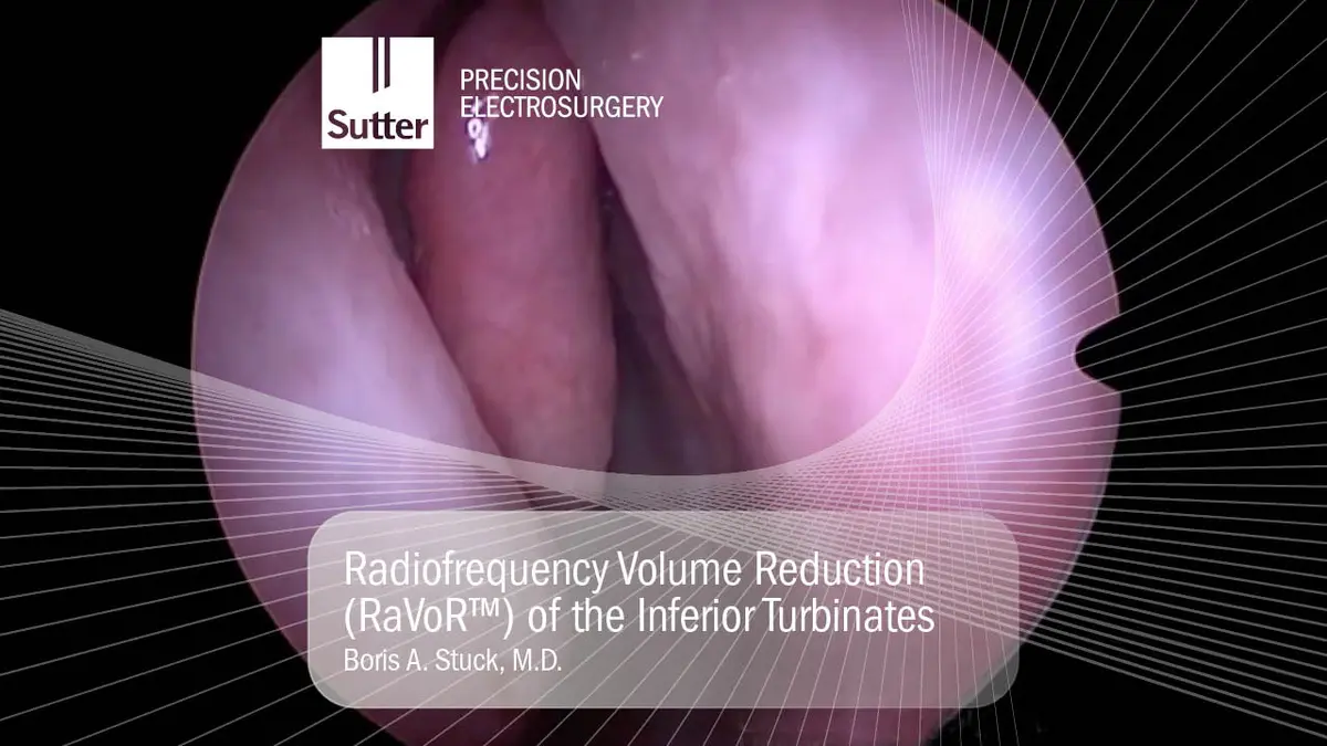 radiofrequency-volume-reduction-ravor-inferior-turbinates-boris-stuck.jpg Radiofrequency volume reduction (RaVoR™) of the inferior turbinates performed by Boris A. Stuck, M.D.