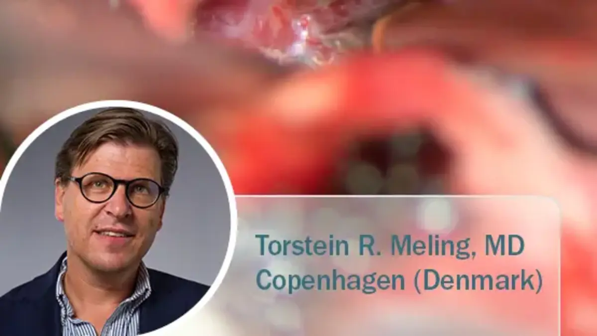 Chirurgische Nahaufnahme einer Oberlidkorrektur mit Radiofrequenz-Technologie; eingeblendet ist Dr. Thomas Mahler, Facharzt für Dermatologie aus Deutschland.